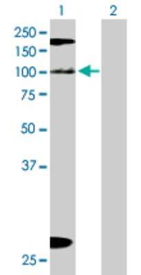 Western Blot: DBC1/p30 Antibody [H00057805-B01P] - Analysis of KIAA1967 expression in transfected 293T cell line by KIAA1967 polyclonal antibody.  Lane 1: KIAA1967 transfected lysate(101.53 KDa). Lane 2: Non-transfected lysate.