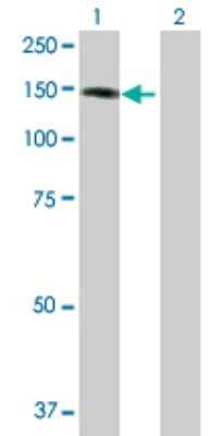 Western Blot: DBC1/p30 Antibody [H00057805-D01P] - Analysis of KIAA1967 expression in transfected 293T cell line by KIAA1967 polyclonal antibody.Lane 1: KIAA1967 transfected lysate(102.90 KDa).Lane 2: Non-transfected lysate.