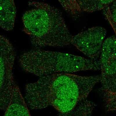 Immunocytochemistry/Immunofluorescence: DBF4 Antibody [NBP2-55268] - Staining of human cell line RH-30 shows localization to nucleoplasm & nuclear bodies.