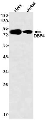 Western Blot: DBF4 Antibody (S06-6I2) [NBP3-15021] - Western blot detection of DBF4 in Hela, Jurkat cell lysates using DBF4 Rabbit mAb (1:500 diluted). Predicted band size: 77kDa. Observed band size: 77kDa.