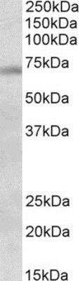 Western Blot: DBF4 Antibody [NBP1-78282] - (1ug/ml) staining of Mouse Testis lysate (35ug protein in RIPA buffer). Primary incubation was 1 hour. Detected by chemiluminescence.