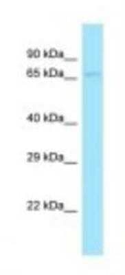 Western Blot: DBF4 Antibody [NBP1-98390] - Mouse Brain Lysate 1.0ug/ml, Gel Concentration: 12%