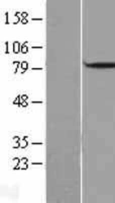 Western Blot: DBF4 Overexpression Lysate (Adult Normal) [NBL1-09726] Left-Empty vector transfected control cell lysate (HEK293 cell lysate); Right -Over-expression Lysate for DBF4.