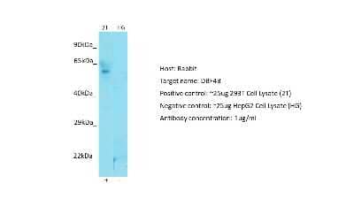 Western Blot: DBF4B Antibody [NBP2-87247] - Host: Rabbit. Target: DBF4B. Positive control (+): 293T Cell Lysate (2T). Negative control (-): HepG2 Cell Lysate (HG). Antibody concentration: 1ug/ml