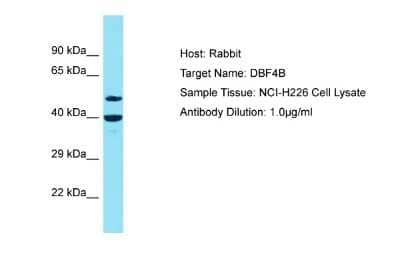 Western Blot: DBF4B Antibody [NBP2-87248] - Host: Rabbit. Target Name: DBF4B. Sample Type: NCI-H226 Whole Cell lysates. Antibody Dilution: 1.0ug/ml