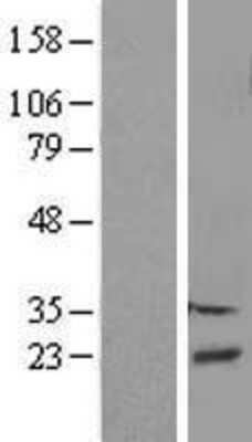 Western Blot: DBNDD2 Overexpression Lysate (Adult Normal) [NBP2-08346] Left-Empty vector transfected control cell lysate (HEK293 cell lysate); Right -Over-expression Lysate for DBNDD2.