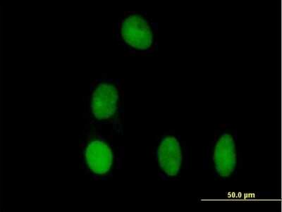 Immunocytochemistry/Immunofluorescence: DBR1 Antibody [H00051163-B01P] - Analysis of purified antibody to DBR1 on HeLa cell. (antibody concentration 10 ug/ml)