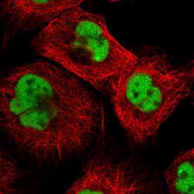 Immunocytochemistry/Immunofluorescence: DBR1 Antibody [NBP1-85907] - Staining of human cell line A-431 shows localization to nucleoplasm. Antibody staining is shown in green.