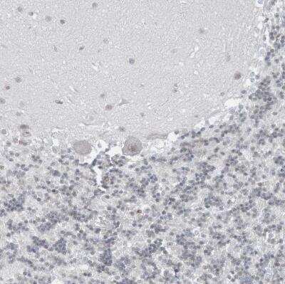 Immunohistochemistry-Paraffin: DBR1 Antibody [NBP1-85907] -  Staining of human cerebellum shows weak nuclear positivity in Purkinje cells.