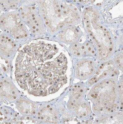 Immunohistochemistry-Paraffin: DBR1 Antibody [NBP1-85907] - Staining of human kidney shows moderate nuclear positivity in cells in tubules.