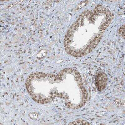 Immunohistochemistry-Paraffin: DBR1 Antibody [NBP1-85907] - Staining of human prostate shows moderate to strong nuclear positivity in glandular cells.