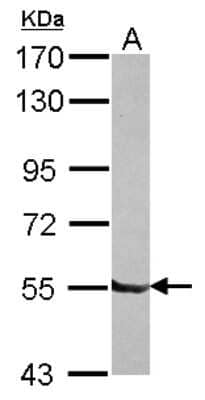 Western Blot: DBR1 Antibody [NBP2-16104] - Sample (30 ug of whole cell lysate) A: A549 7. 5% SDS PAGE gel, diluted at 1:1000.