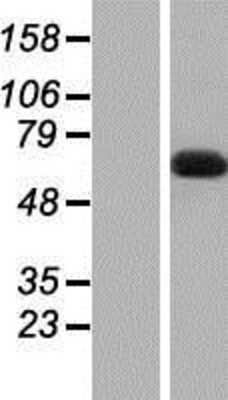 Western Blot DBR1 Overexpression Lysate