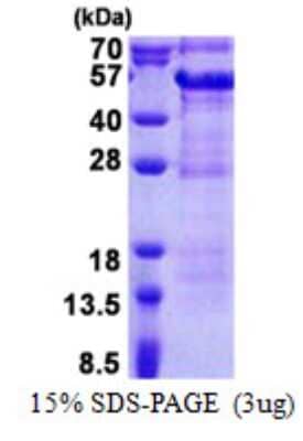 SDS-PAGE Recombinant Human DBR1 His Protein