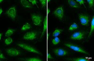 Immunocytochemistry/Immunofluorescence: DBT Antibody [NBP1-31760] -  HeLa cells were fixed in 4% paraformaldehyde at RT for 15 min. Green: DBT stained by DBT antibody diluted at 1:500. Blue: Hoechst 33342 staining. Scale bar= 10 um.