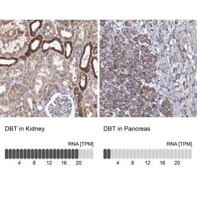 Immunohistochemistry-Paraffin: DBT Antibody [NBP1-85963] - Staining in human kidney and pancreas tissues using anti-DBT antibody. Corresponding DBT RNA-seq data are presented for the same tissues.