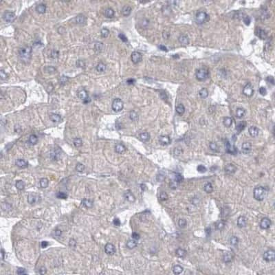 Immunohistochemistry-Paraffin: DBT Antibody [NBP1-85963] - Staining of human liver.