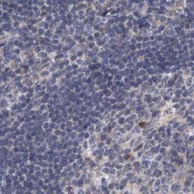 Immunohistochemistry-Paraffin: DBT Antibody [NBP1-85963] - Staining of human lymph node.