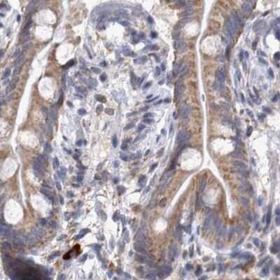 Immunohistochemistry-Paraffin: DBT Antibody [NBP1-85963] - Staining of human colon.