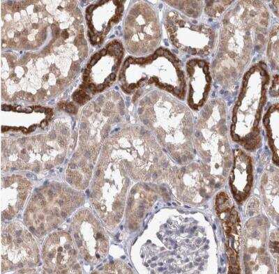 Immunohistochemistry-Paraffin: DBT Antibody [NBP1-85963] - Staining of human kidney shows high expression.