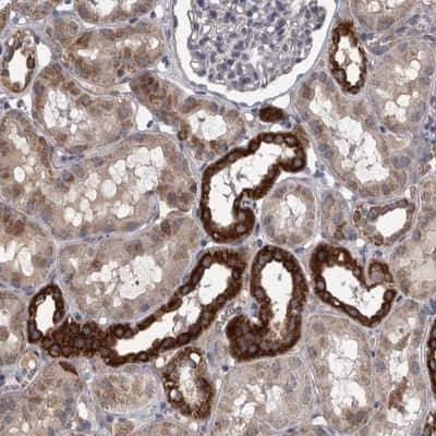 Immunohistochemistry-Paraffin: DBT Antibody [NBP1-85964] - Staining of human kidney shows strong cytoplasmic positivity in distal tubules.