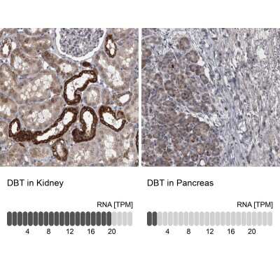 <b>Orthogonal Strategies Validation. </b>Immunohistochemistry-Paraffin: DBT Antibody [NBP1-85964] - Staining in human kidney and pancreas tissues using anti-DBT antibody. Corresponding DBT RNA-seq data are presented for the same tissues.