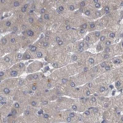 Immunohistochemistry-Paraffin: DBT Antibody [NBP1-85964] - Staining of human liver.