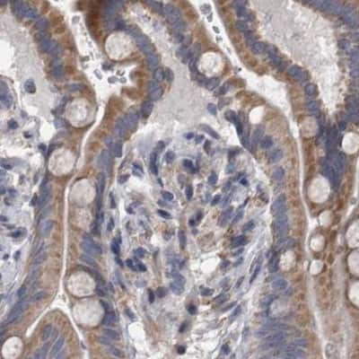 <b>Independent Antibodies Validation. </b>Immunohistochemistry-Paraffin: DBT Antibody [NBP1-85964] - Staining of human colon.