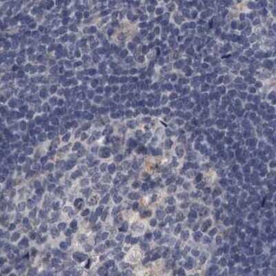 Immunohistochemistry-Paraffin: DBT Antibody [NBP1-85964] - Staining of human lymph node.