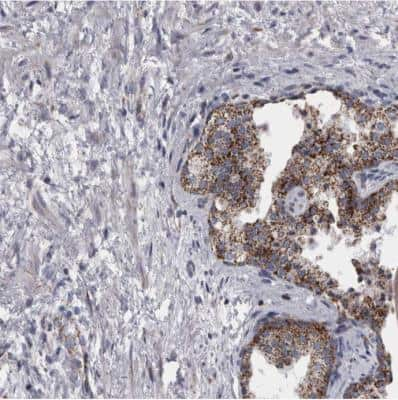 Immunohistochemistry-Paraffin: DBT Antibody [NBP1-89522] - Staining of human prostate shows weak to moderate cytoplasmic positivity in glandular cells.