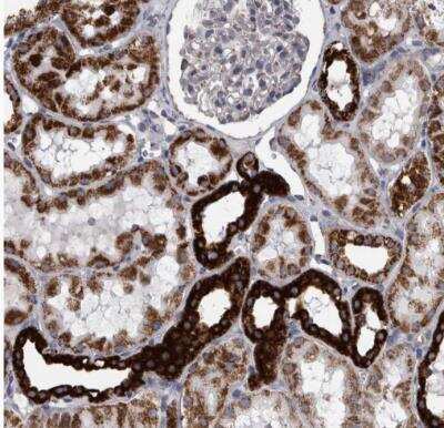 Immunohistochemistry-Paraffin: DBT Antibody [NBP1-89522] - Staining of human kidney shows moderate to strong cytoplasmic positivity in cells in tubules.