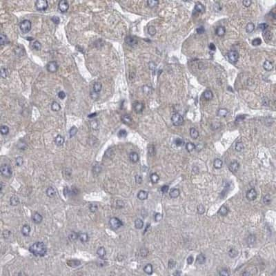 Immunohistochemistry-Paraffin: DBT Antibody [NBP1-89522] - Staining of human liver.