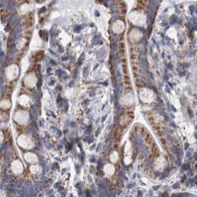 Immunohistochemistry-Paraffin: DBT Antibody [NBP1-89522] - Staining of human colon.