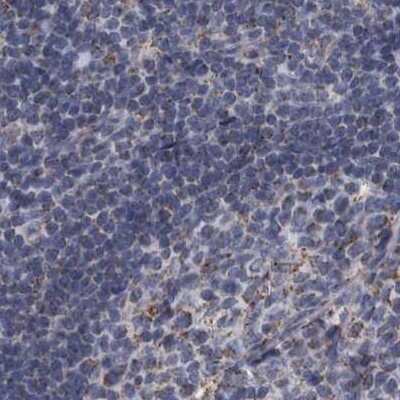 Immunohistochemistry-Paraffin: DBT Antibody [NBP1-89522] - Staining of human lymph node.