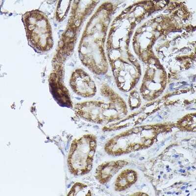 Immunohistochemistry-Paraffin: DBT Antibody [NBP3-16010] - Immunohistochemistry of paraffin-embedded mouse kidney using DBT Rabbit pAb (NBP3-16010) at dilution of 1:50 (40x lens).Perform high pressure antigen retrieval with 10 mM citrate buffer pH 6.0 before commencing with IHC staining protocol.