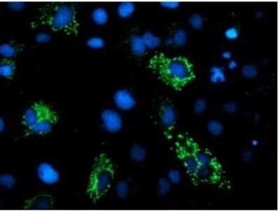 Immunocytochemistry/Immunofluorescence: DBT Antibody (OTI1G2) - Azide and BSA Free [NBP2-70553] - Staining of COS7 cells transiently transfected by pCMV6-ENTRY DBT.