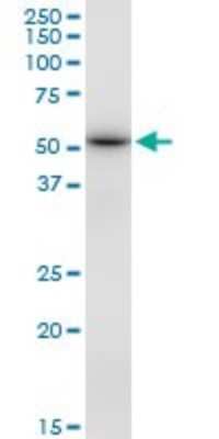 Western Blot: DBT Antibody [H00001629-B01P] - Analysis of DBT expression in A-431.