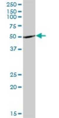 Western Blot: DBT Antibody [H00001629-B01P] - Analysis of DBT expression in human liver.