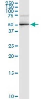 Western Blot: DBT Antibody [H00001629-D01P] - Analysis of DBT expression in A-431.