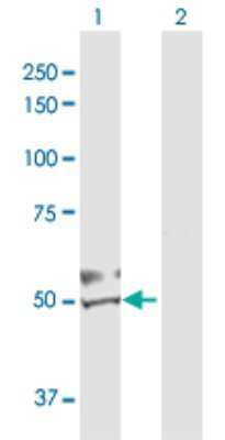 Western Blot: DBT Antibody [H00001629-D01P] - Analysis of DBT expression in transfected 293T cell line by DBT polyclonal antibody.Lane 1: DBT transfected lysate(53.50 KDa).Lane 2: Non-transfected lysate.