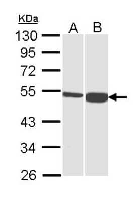 Western Blot: DBT Antibody [NBP1-31760] - Sample (30 ug of whole cell lysate) A: H1299 B: Hep G2 10% SDS PAGE; antibody diluted at 1:1000.