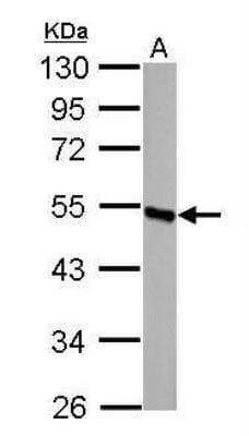 Western Blot: DBT Antibody [NBP1-31760] - A. 50 ug rat liver lysate/extract  10% SDS-PAGE DBT antibody dilution: 1:1000  The HRP-conjugated anti-rabbit IgG antibody was used to detect the primary antibody.