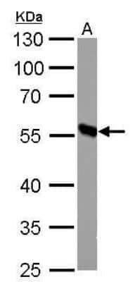 Western Blot: DBT Antibody [NBP1-31760] - A. 50 ug mouse liver lysate/extract  10% SDS-PAGE DBT antibody dilution: 1:1000  The HRP-conjugated anti-rabbit IgG antibody was used to detect the primary antibody.