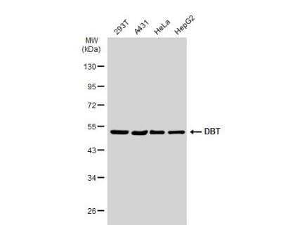 Western Blot: DBT Antibody [NBP1-31760] - Various whole cell extracts (30 ug) were separated by 10% SDS-PAGE, and the membrane was blotted with DBT antibody diluted at 1:1000. The HRP-conjugated anti-rabbit IgG antibody (NBP2-19301) was used to detect the primary antibody