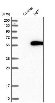 <b>Orthogonal Strategies Validation. </b>Western Blot: DBT Antibody [NBP1-85963] - Analysis in control (vector only transfected HEK293T lysate) and DBT over-expression lysate (Co-expressed with a C-terminal myc-DDK tag (3.1 kDa) in mammalian HEK293T cells).