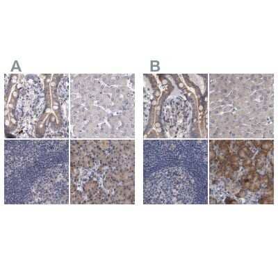 <b>Independent Antibodies Validation. </b>Immunohistochemistry-Paraffin: DBT Antibody [NBP1-85963] - Staining of human colon, liver, lymph node and pancreas using Anti-DBT antibody NBP1-85963 (A) shows similar protein distribution across tissues to independent antibody NBP1-85964 (B).