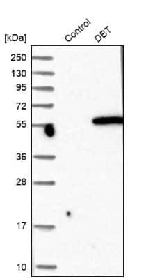 Western Blot: DBT Antibody [NBP1-85964] - Analysis in control (vector only transfected HEK293T lysate) and DBT over-expression lysate (Co-expressed with a C-terminal myc-DDK tag (3.1 kDa) in mammalian HEK293T cells).