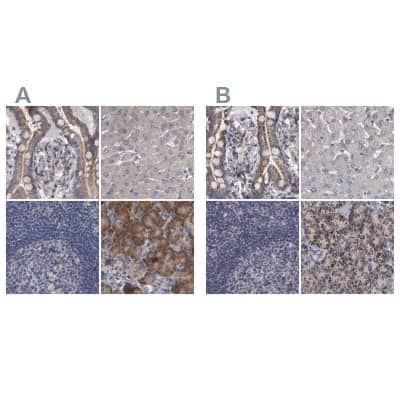 Western Blot: DBT Antibody [NBP1-85964] - Staining of human colon, liver, lymph node and pancreas using Anti-DBT antibody NBP1-85964 (A) shows similar protein distribution across tissues to independent antibody NBP1-89522 (B).