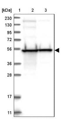 Western Blot: DBT Antibody [NBP1-89522] - Lane 1: Marker  [kDa] 230, 130, 95, 72, 56, 36, 28, 17, 11.  Lane 2: Human cell line RT-4.  Lane 3: Human cell line U-251MG sp