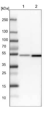 Western Blot: DBT Antibody [NBP1-89522] - Lane 1: NIH-3T3 cell lysate (Mouse embryonic fibroblast cells). Lane 2: NBT-II cell lysate (Rat Wistar bladder tumor cells).